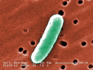 E. coli-Bakterium: Biocomputer wird ein Stück realer (Foto: CDC/Janice H. Carr)