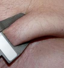 Fettschürze: Birgt erhebliches Krebsrisiko (Foto: pixelio.de, Dieter Schütz) Fettschürze: Birgt erhebliches Krebsrisiko (Foto: pixelio.de, Dieter Schütz)