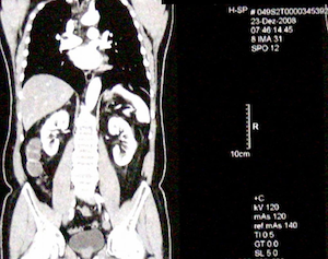 Spenderniere gefunden: Twitter hilft Usern (Foto: pixelio.de/Hartmut910)