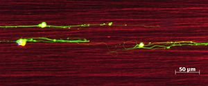Scan: Nervenzellen, die an Seidenfäden (rot) wachsen (Quelle: Uniklinik Leipzig)
