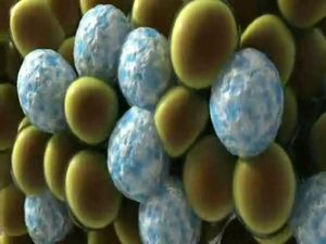 Kryolipolyse schematisch (Foto: Zeltiq Aesthetics, Pleasanton CA)