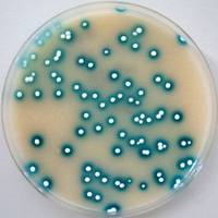 Actinomyceten in Petrischale (Foto: HZI)