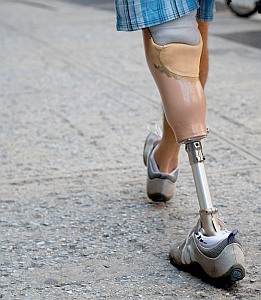 Beinprothese: Verlorene Gliedmaße schmerzt oft weiter (Foto: Flickr/Leuthard)