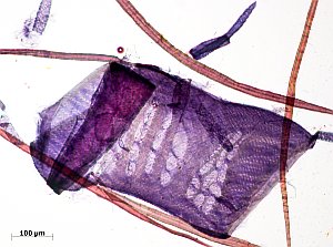 Zellstoff-Zelle aus Tropenholz: Nachweis möglich (Foto: TU Darmstadt/Schaffrath)