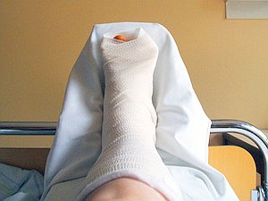 Gips: Eine Fachdisziplin allein für Schmerz oft zu wenig (Foto: pixelio.de/Pelz)