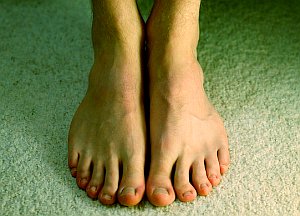 Füße: Erfordern bei Diabetes erhöhtes Augenmerk (Foto: Flickr/Tentwo)