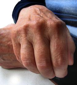 Alte Hände: Zittern eines der Symptome (Foto: pixelio.de, Gerd Altmann)