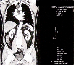 Anatomie: Alter Mann möchte helfen (Foto: pixelio.de, Hartmut910)
