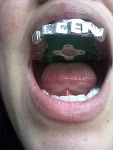 MP3-Player im Mund: Der MP3-Player im Mund: Der