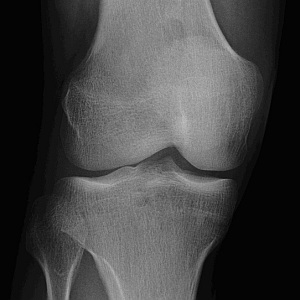 Knie: Gelenk als vielversprechende Energiequelle (Foto: Flickr/akeg) Knie: Gelenk als vielversprechende Energiequelle (Foto: Flickr/akeg)