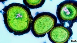 MRSA: tödliche Keime ohne Gegenmaßnahmen auf dem Vormarsch (Foto: SPL)