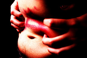 Fettleibigkeit: mindert Gehirnleistung (Foto: flickr.com/LauraLewis23)