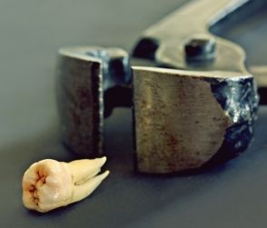 Zahn: guter Platz für Sensor (Foto: pixelio.de, birgith) Zahn: guter Platz für Sensor (Foto: pixelio.de, birgith)