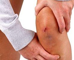 Knie: muss viele Belastungen ertragen (Foto: pixelio, Thomas Siepmann)