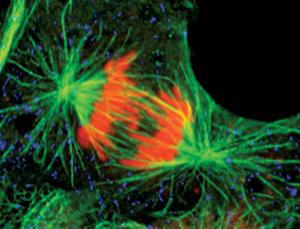 Amöben: Tauziehen für Zellteilung (Foto: Thomas Deerinick, NCMIR/SPL) Amöben: Tauziehen für Zellteilung (Foto: Thomas Deerinick, NCMIR/SPL)