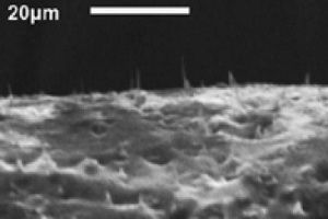 Unter dem Mikroskop: Membran mit Nano-Nadeln (Foto: ncsu.edu) Unter dem Mikroskop: Membran mit Nano-Nadeln (Foto: ncsu.edu)