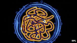 Hepatitis C: Viele wissen nicht, dass sie das Virus in sich tragen (Foto: SPL)