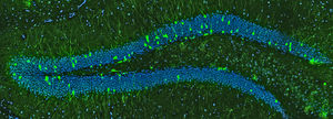 Neue Nervenzellen im Gehirn einer Maus (Foto: Ana Martin-Villalba, dkfz.de)