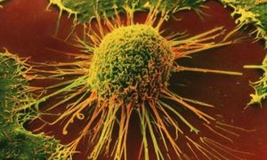 Virus JX-594: Krebs wird auf direktem Wege zerstört (Foto: adderalljunkie.com)