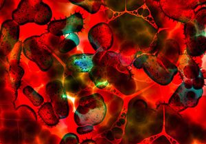 Immunsystem: reagiert häufig anders als gedacht (Foto: pixelio.de, Gerd Altmann)
