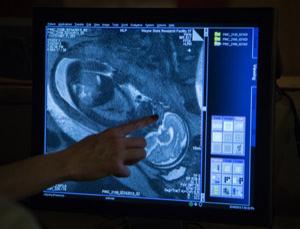 Fötus-Scan: zeigt, wie sich Gehirn früh entwickelt (Foto: wayne.edu, Rob Widdis)