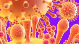 Schweinegrippe: Neues Virus breitet sich rasend schnell aus (Foto. SPL)