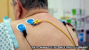 Untersuchung: Todeszahlen bei Herzleiden EU-weit im Rückgang (Foto: SPL) Untersuchung: Todeszahlen bei Herzleiden EU-weit im Rückgang (Foto: SPL)