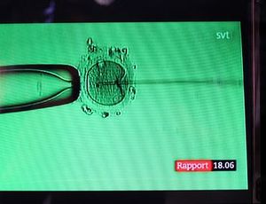 IVF: Kosten lassen sich drastisch senken (Foto: flickr/Solis Invictis)