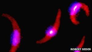 Wirkung des neuen Impfstoffs: lebende Parasiten im Fokus (Foto: Robert Seder) Wirkung des neuen Impfstoffs: lebende Parasiten im Fokus (Foto: Robert Seder)