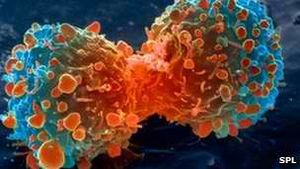 Krebs: Immunsystem des eigenen Körpers als Ansatzpunkt (Foto: SPL)