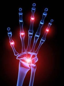 Hand: Im Alter ziehen Schmerzen in die Gelenke (Foto: fotolia.com, S. Kaulitzki)