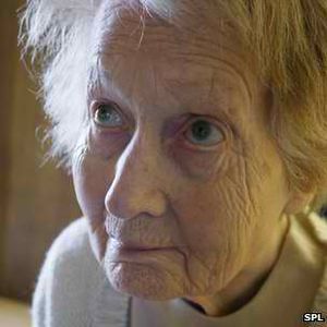 Alzheimer-Patientin: Ursachen werden klarer (Foto: SPL)