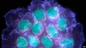 Krebs: Nachgewiesene Vielfalt erschwert die Behandlung (Foto: SPL)