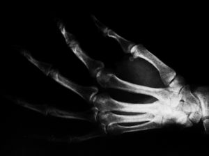 Hand: Synchrotron-Strahlung in der Medizin (Foto: pixelio.de/Sabine Koriath) Hand: Synchrotron-Strahlung in der Medizin (Foto: pixelio.de/Sabine Koriath)