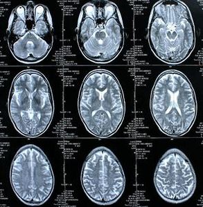 Schnittbilder des Gehirns: Forscher wollen es züchten (Foto: pixelio.de, Rike)