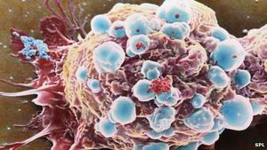 Krebszellen: Nanopartikel zerstören Turmor bei direktem Kontakt (Foto: SPL)