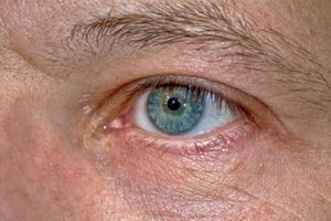 Auge: Gentherapie bringt Hoffnung für Blinde (Foto: pixelio.de, Templermeister)