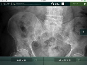 Handy röntgen app