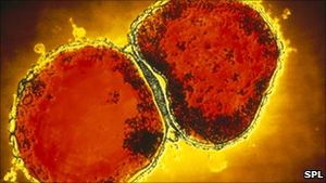 Meningitis: Ein schnellerer und genauerer Test schafft Klarheit (Foto: SPL)