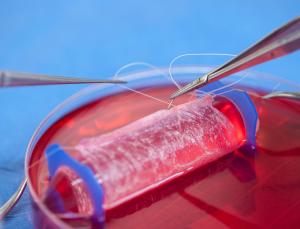 Künstlich hergestellte Vagina: Transplantat aus dem Labor (Foto: bit.ly/1efKpGK)