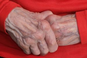 Alte Hände: Mehr Wissen um Demenz dringend notwendig (Foto: pixelio.de, Fotobox)