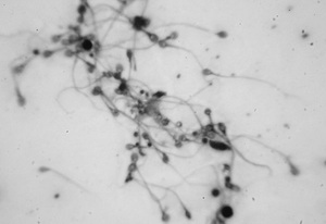 Sperma: Neue Hoffnung für krebskranke Jungen (Foto: flickr.com/Toby)