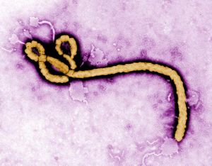 Ebola: Molekül-Computer erkennt Virus schnell (Foto: cdc.gov)