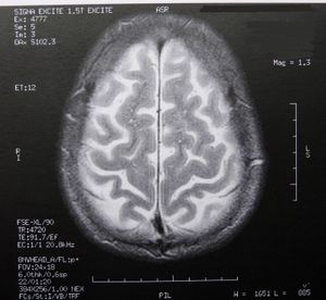 Gehirn: Schäden sind teilweise ausgleichbar (Foto: pixelio.de, Dieter Schütz)
