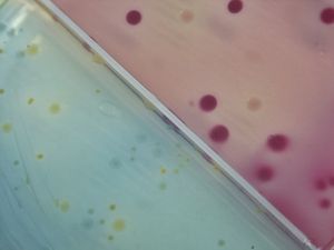 Bakterien: Forscher kreieren neue Antibiotika (Foto: pixelio.de, C. Menichelli)