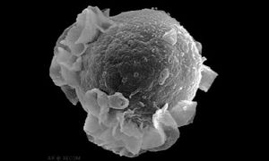 Virus: blockiert Immunsystem (Foto: utexas.edu, A. Einstein College of Medicine)