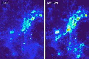 Gehirnstimulation: Nanopartikel statt Elektroden genutzt (Foto: web.mit.edu)