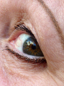 Auge: Mensch hat andere Augenhöhlen als Primaten (Foto: pixelio.de, Lupo)
