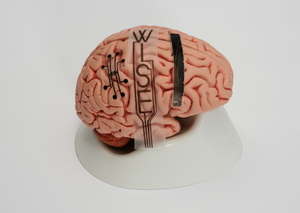 Gehirn mit Implantat: neue Therapien werden möglich (Foto: wiseneuro.com)