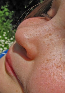 Nase: Riechtest weist Autismus in zehn Minuten nach (Foto: pixelio.de, TKJ1966) Nase: Riechtest weist Autismus in zehn Minuten nach (Foto: pixelio.de, TKJ1966)